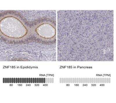 Immunohistochemistry-Paraffin: ZNF185 Antibody [NBP1-86452] - Analysis in human epididymis and pancreas tissues using NBP1-86452 antibody. Corresponding ZNF185 RNA-seq data are presented for the same tissues.