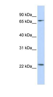 Western Blot: ZNF185 Antibody [NBP1-80320] - Hela cell lysate, concentration 0.2-1 ug/ml.