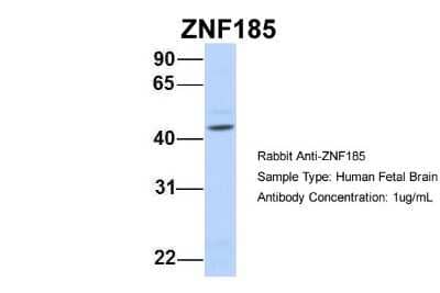 Western Blot: ZNF185 Antibody [NBP1-80320] - Human Fetal Brain, Antibody Dilution: 1.0 ug/ml.