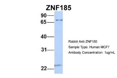 Western Blot: ZNF185 Antibody [NBP1-80320] - MCF7, Antibody Dilution: 1.0 ug/ml ZNF185 is supported by BioGPS gene expression data to be expressed in MCF7.
