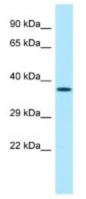 Western Blot: ZNF185 Antibody [NBP3-10319] - Western blot analysis of ZNF185 in Mouse Stomach lysates. Antibody dilution at 1.0ug/ml