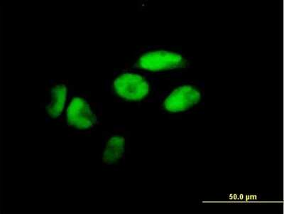 Immunocytochemistry/Immunofluorescence: ZNF187 Antibody [H00007741-B01P] - Analysis of purified antibody to ZNF187 on HeLa cell. (antibody concentration 10 ug/ml)