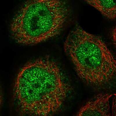 Immunocytochemistry/Immunofluorescence: ZNF187 Antibody [NBP2-58385] - Staining of human cell line A-431 shows localization to nucleoplasm & cytosol.