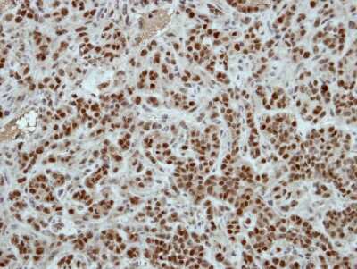 Immunohistochemistry-Paraffin ZNF187 Antibody