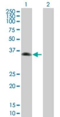 Western Blot: ZNF187 Antibody [H00007741-B01P] - analysis of ZNF187 expression in transfected 293T cell line by ZNF187 MaxPab polyclonal antibody. Lane 1: ZNF187 transfected lysate (35.75 KDa). Lane 2: Non-transfected lysate.
