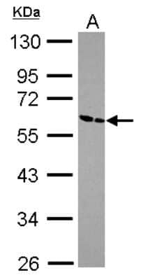 Western Blot ZNF187 Antibody