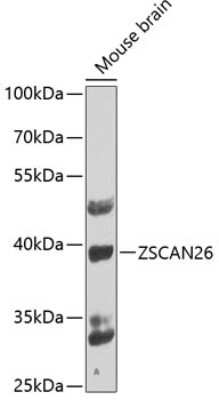 Western Blot: ZNF187 Antibody [NBP3-03215] - Analysis of extracts of mouse brain, using ZNF187 antibody at 1:1000 dilution. Secondary antibody: HRP Goat Anti-Rabbit IgG (H+L) at 1:10000 dilution. Lysates/proteins: 25ug per lane. Blocking buffer: 3% nonfat dry milk in TBST. Detection: ECL Basic Kit .