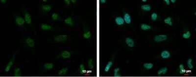 Immunocytochemistry/Immunofluorescence: ZNF189 Antibody [NBP2-20971] - HeLa cells were fixed in 4% paraformaldehyde at RT for 15 min. Green: ZNF189 protein stained by ZNF189 antibody  diluted at 1:2000. Blue: Hoechst 33342 staining.