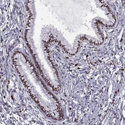 Immunohistochemistry-Paraffin ZNF19 Antibody - BSA Free