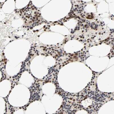 Immunohistochemistry-Paraffin ZNF192 Antibody