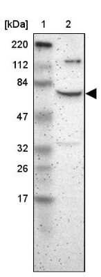 Western Blot ZNF192 Antibody