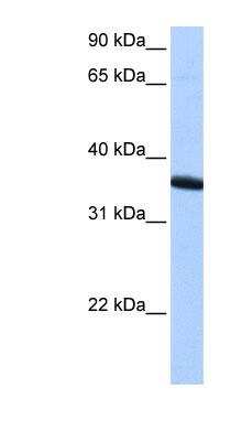Western Blot: ZNF192P1 Antibody [NBP1-91413] - HepG2 cell lysate, concentration 0.2-1 ug/ml.