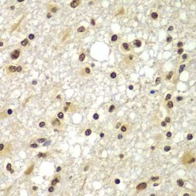 Immunohistochemistry-Paraffin ZNF20 Antibody - BSA Free