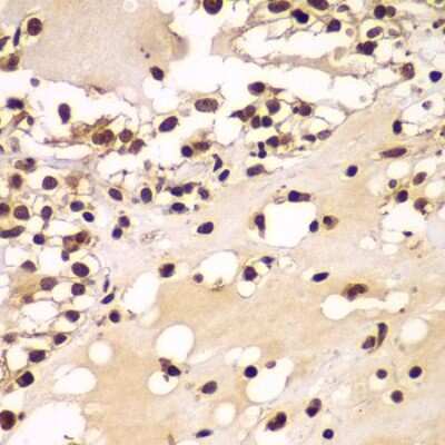 Immunohistochemistry-Paraffin ZNF20 Antibody - BSA Free