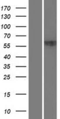 Western Blot: ZNF20 Overexpression Lysate (Adult Normal) [NBP2-06559] Left-Empty vector transfected control cell lysate (HEK293 cell lysate); Right -Over-expression Lysate for ZNF20.