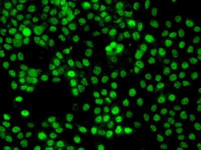 Immunocytochemistry/Immunofluorescence: ZNF205 Antibody [NBP3-06486] - Staining of ZNF205 in A431 cells. Cells were fixed with 4% PFA, permeabilzed with 0.1% Triton X-100 in PBS,blocked with 10% serum, and incubated with rabbit anti-Human ZNF205 polyclonal antibody (dilution ratio 1:200) at 4? overnight. Then cells were stained with the Alexa Fluor®488-conjugated Goat Anti-rabbit IgG secondary antibody (green). Positive staining was localized to Nucleus.