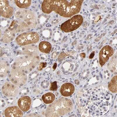 Immunohistochemistry-Paraffin ZNF205 Antibody