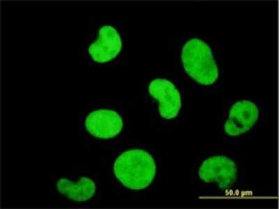 Immunocytochemistry/Immunofluorescence: ZNF207 Antibody (6H8) [H00007756-M03] - Analysis of monoclonal antibody to ZNF207 on HeLa cell. Antibody concentration 10 ug/ml