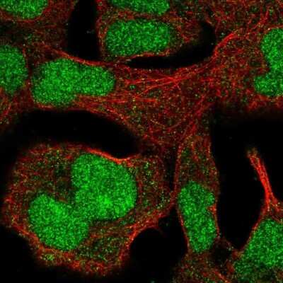 Immunocytochemistry/ Immunofluorescence ZNF207 Antibody