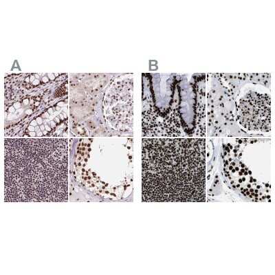 Immunohistochemistry-Paraffin ZNF207 Antibody