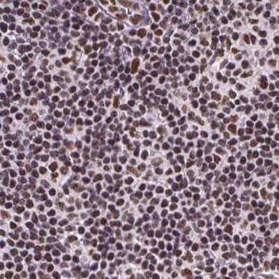 Immunohistochemistry-Paraffin ZNF207 Antibody