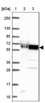 Western Blot ZNF207 Antibody - BSA Free
