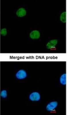 Immunocytochemistry/Immunofluorescence: ZNF211 Antibody [NBP1-32446] - Paraformaldehyde-fixed HeLa, using antibody at 1:200 dilution.