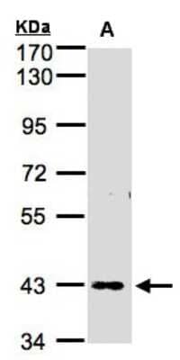 Western Blot: ZNF211 Antibody [NBP1-32446] - Sample(30 ug whole cell lysate)A:H12997. 5% SDS PAGE, antibody diluted at 1:1000.