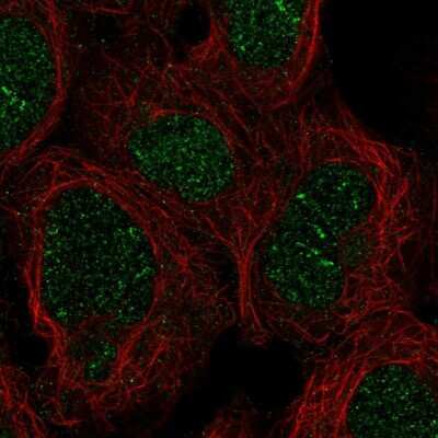 Immunocytochemistry/ Immunofluorescence ZNF212 Antibody - BSA Free