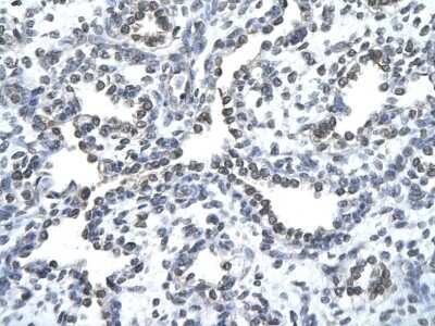 Immunohistochemistry-Paraffin ZNF212 Antibody - BSA Free