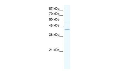 Western Blot: ZNF212 Antibody [NBP2-88654] - WB Suggested Anti-ZNF212 Antibody Titration: 1.25ug/ml. Positive Control: K562 cell lysate