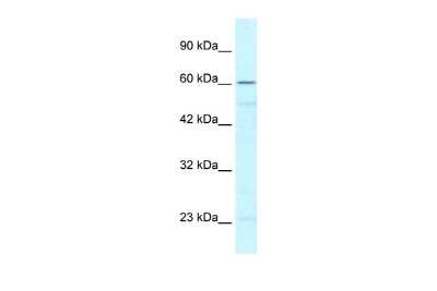 Western Blot ZNF212 Antibody - BSA Free