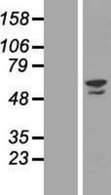 Western Blot ZNF212 Overexpression Lysate