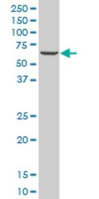 Western Blot: ZNF215 Antibody (1D12) [H00007762-M03] - Analysis of ZNF215 expression in A-431 (Cat # L015V1).