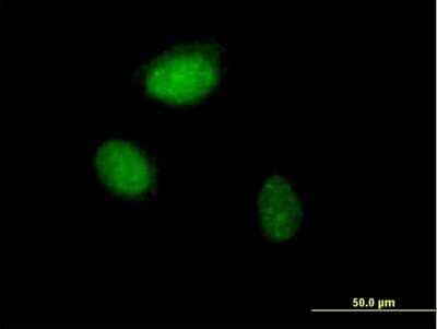 Immunocytochemistry/Immunofluorescence: ZNF215 Antibody [H00007762-B01P] - Analysis of purified antibody to ZNF215 on HeLa cell. (antibody concentration 10 ug/ml)