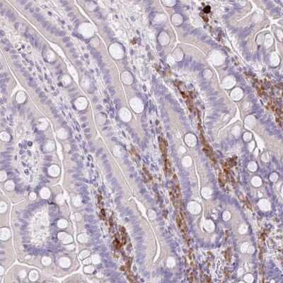 Immunohistochemistry: ZNF215 Antibody [NBP2-48992] - Staining of human duodenum shows leukocyte positivity in glandular cells.