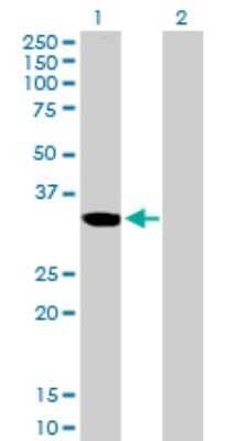 Western Blot: ZNF215 Antibody [H00007762-B01P] - Analysis of ZNF215 expression in transfected 293T cell line by ZNF215 polyclonal antibody.  Lane 1: ZNF215 transfected lysate(33.44 KDa). Lane 2: Non-transfected lysate.