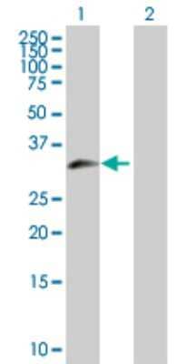 Western Blot: ZNF215 Antibody [H00007762-D01P] - Analysis of ZNF215 expression in transfected 293T cell line by ZNF215 polyclonal antibody.Lane 1: ZNF215 transfected lysate(35.30 KDa).Lane 2: Non-transfected lysate.