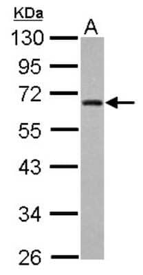 Western Blot: ZNF215 Antibody [NBP2-20977] - Sample (30 ug of whole cell lysate) A: A431 10% SDS PAGE gel, diluted at 1:1000.