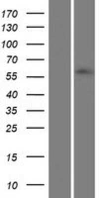 Western Blot: ZNF215 Overexpression Lysate (Adult Normal) [NBP2-07431] Left-Empty vector transfected control cell lysate (HEK293 cell lysate); Right -Over-expression Lysate for ZNF215.