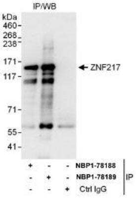 Immunoprecipitation: ZNF217 Antibody [NBP1-78188] - Whole cell lysate (1 mg for IP, 20% of IP loaded) from Jurkat cells. Affinity purified rabbit anti-ZNF217 antibody  used for IP at 6 mcg/mg lysate.  ZNF217 was also immunoprecipitated by rabbit anti-ZNF217 antibody NBP1-78189, which recognizes a downstream epitope.
