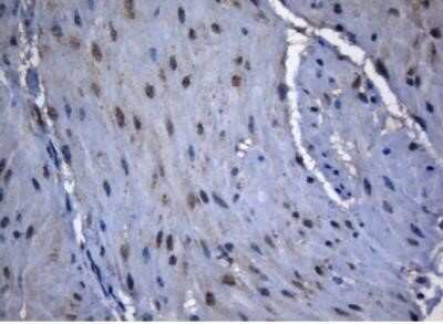 Immunohistochemistry: ZNF217 Antibody (OTI3G5) - Azide and BSA Free [NBP2-74933] - Staining of paraffin-embedded Human lung tissue within the normal limits using anti ZNF217 mouse monoclonal antibody.(Heat-induced epitope retrieval by 1mM EDTA in 10mM Tris buffer (pH8.5) at 120 degrees C for 3 min,1:150)