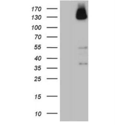 Western Blot: ZNF217 Antibody (OTI3G5) - Azide and BSA Free [NBP2-74933] - HEK293T cells were transfected with the pCMV6- ENTRY control (Left lane) or pCMV6-ENTRY ZNF217 ( Right lane) cDNA for 48 hrs and lysed. Equivalent amounts of cell lysates (5 ug per lane) were separated by SDS-PAGE and immunoblotted with anti ZNF217.(1:200