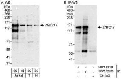 Western Blot ZNF217 Antibody