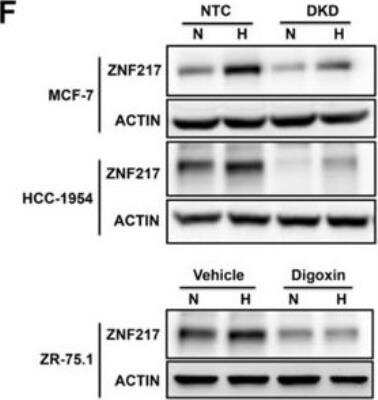 Western Blot ZNF217 Antibody