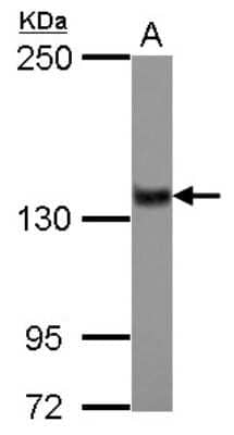 Western Blot: ZNF217 Antibody [NBP2-20978] - Sample (30 ug of whole cell lysate) A: IMR32 5% SDS PAGE gel, diluted at 1:1000.