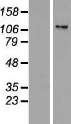 Western Blot: ZNF217 Overexpression Lysate (Adult Normal) [NBP2-07608] Left-Empty vector transfected control cell lysate (HEK293 cell lysate); Right -Over-expression Lysate for ZNF217.