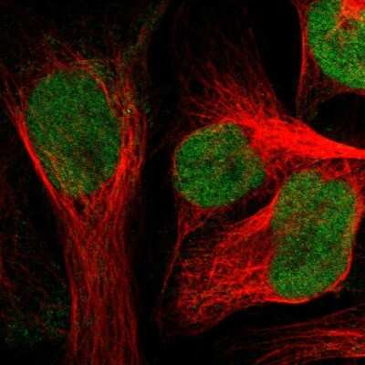 Immunocytochemistry/ Immunofluorescence ZNF22 Antibody - BSA Free