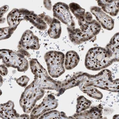 Immunohistochemistry-Paraffin ZNF22 Antibody - BSA Free
