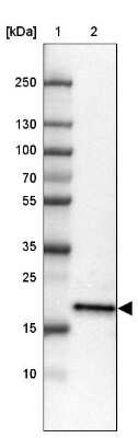 Western Blot ZNF22 Antibody - BSA Free